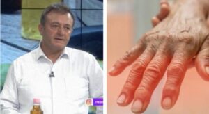 Ylli Merja, Artriti