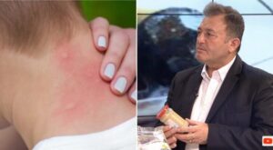 Ylli Merja, Pickimet e insekteve