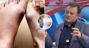 Ylli Merja, Kembet Diabetike