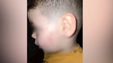 Ndodh sërish! Edukatorja dh*non 3 vjecarin në tiranë, drejtoresha e kopshtit “i lë” nënës Zotin: Allahu të ta marrë hakun