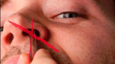 Sipas mjekut te njohur, kjo eshte arsyeja perse nuk duhet qe ti hiqni qimet e hundes